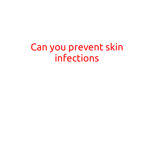 Can You Prevent Skin Infections?